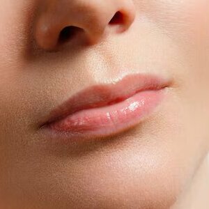 mujer hace correccion forma labios clinica cosmetologia inyecciones labios aumento labios 168410 1918 1 1